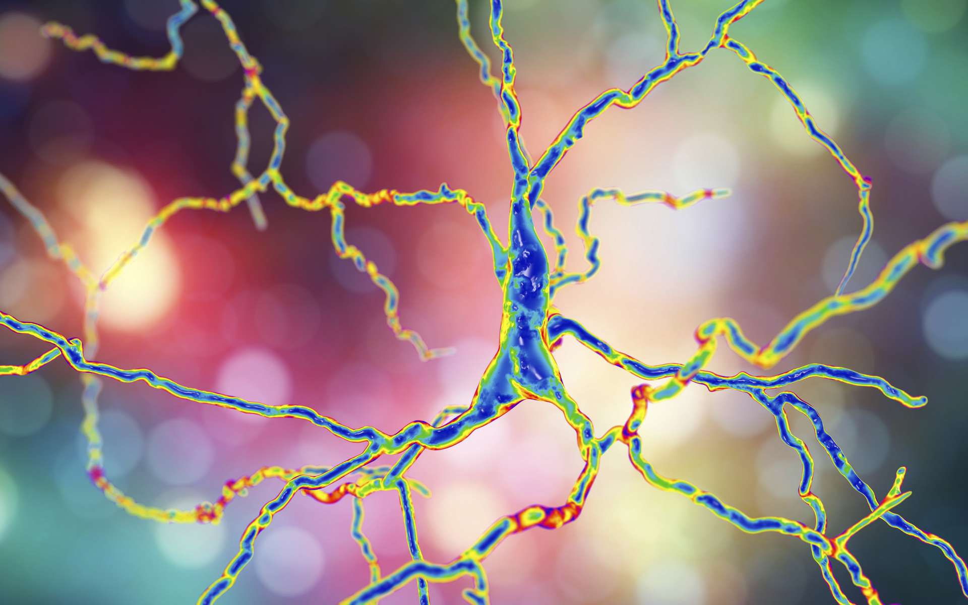 Les Lysosomes Des Chevaux De Troie Dans La Maladie De Parkinson