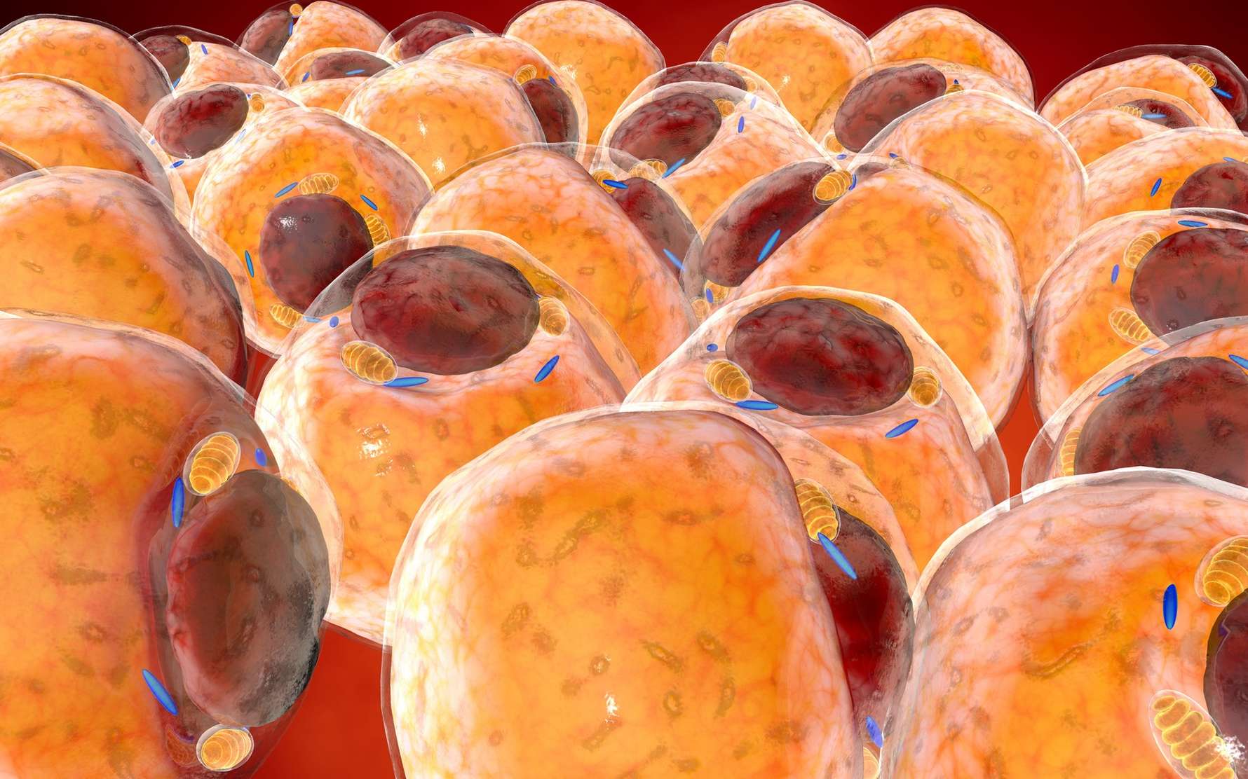 Des chercheurs ont forcé des cellules cancéreuses à se transformer en adipocytes. © chagpg, Fotolia