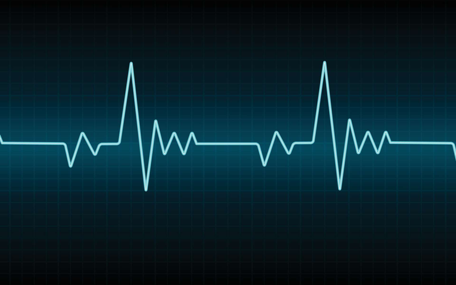 Définition  Électrocardiogramme - ECG  Futura Santé