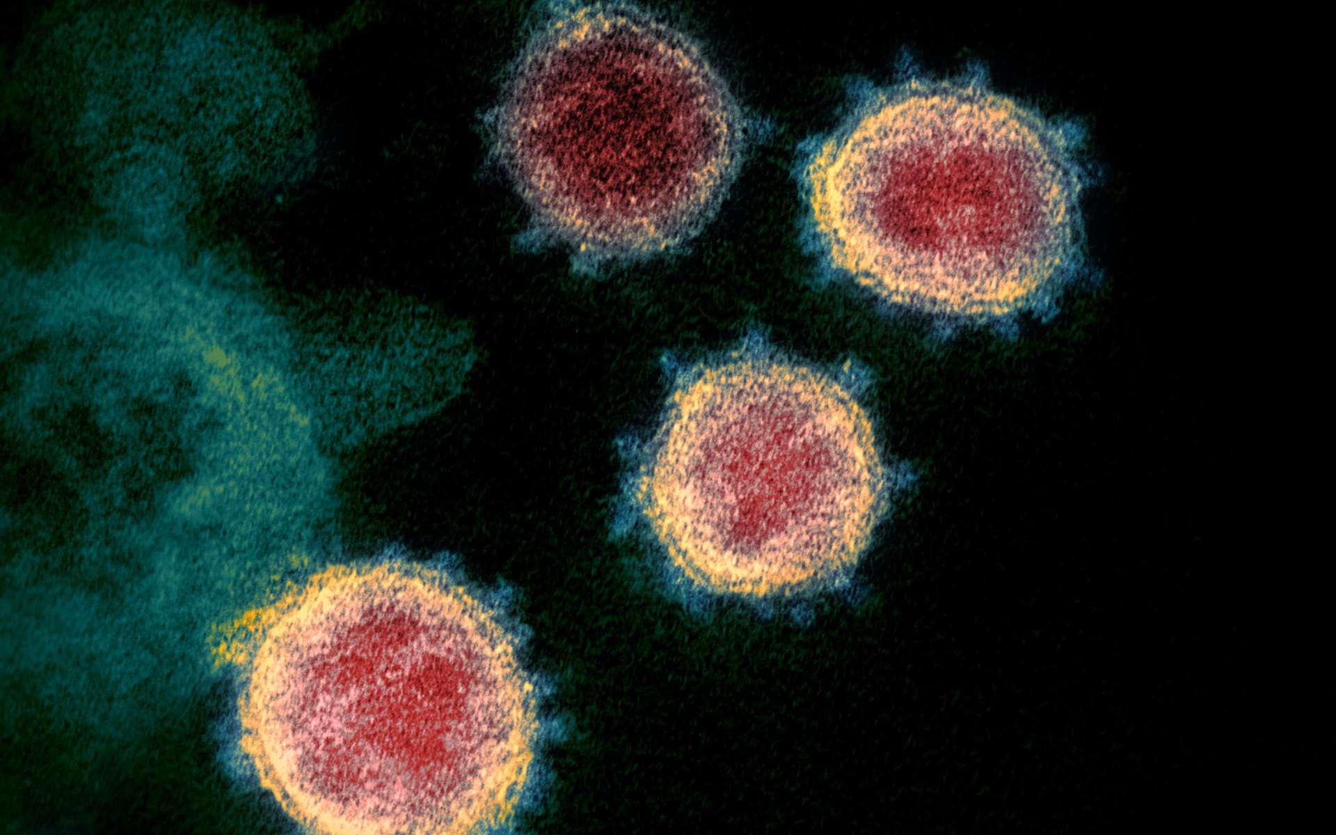 Un anticorps hautement neutralisant capable de s'attaquer à tous les variants du SARS-CoV-2