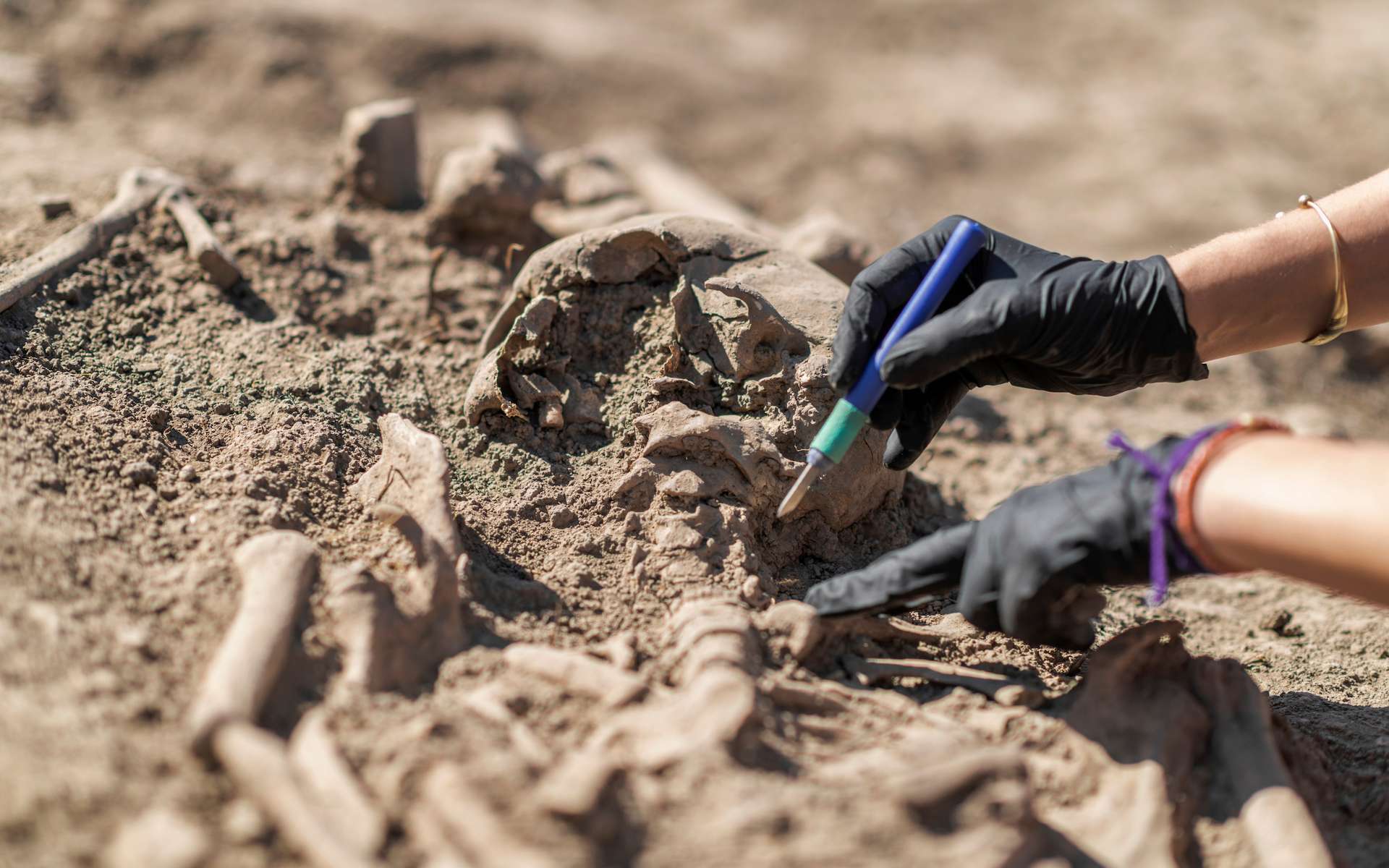 Un squelette du Moyen Âge découvert avec une main de fer