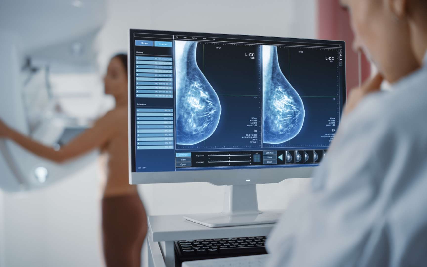 Pour la première fois, une Intelligence artificielle diagnostique avec précision le cancer du sein