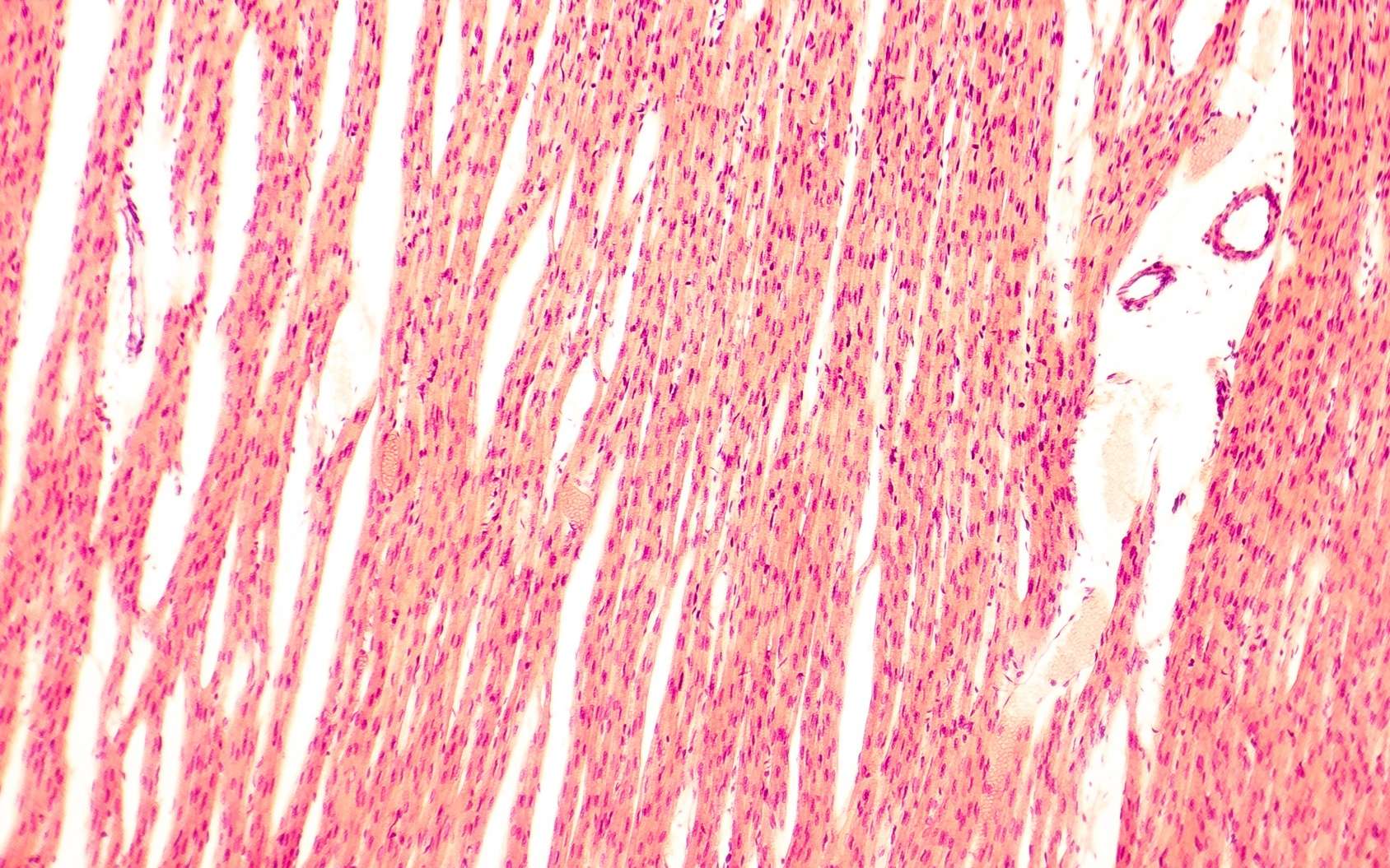 Définition Cardiomyocyte Myocyte cardiaque Futura Santé