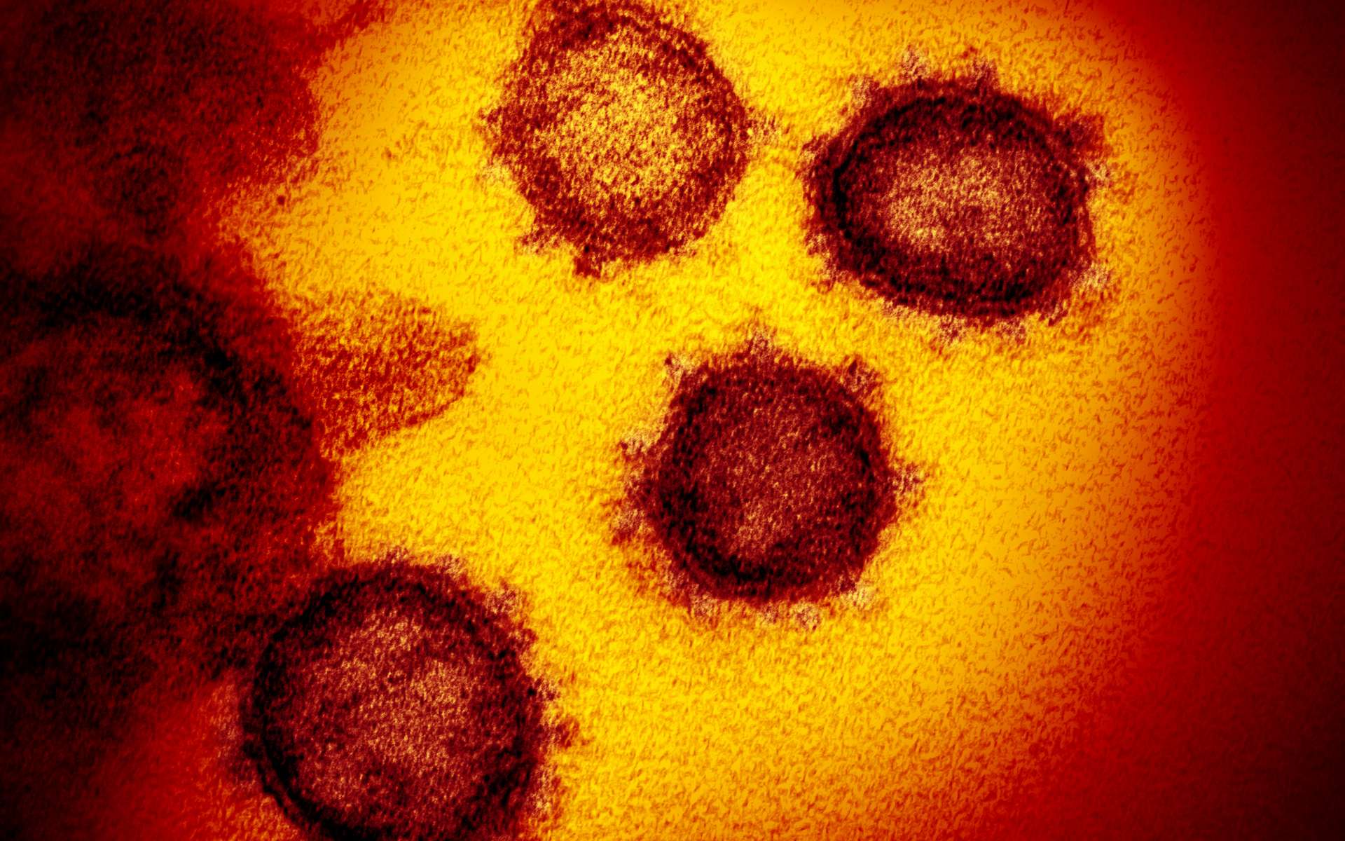 Coronavirus Covid-19 : a-t-on raté l'occasion de l'éviter il y a 7 ans ?