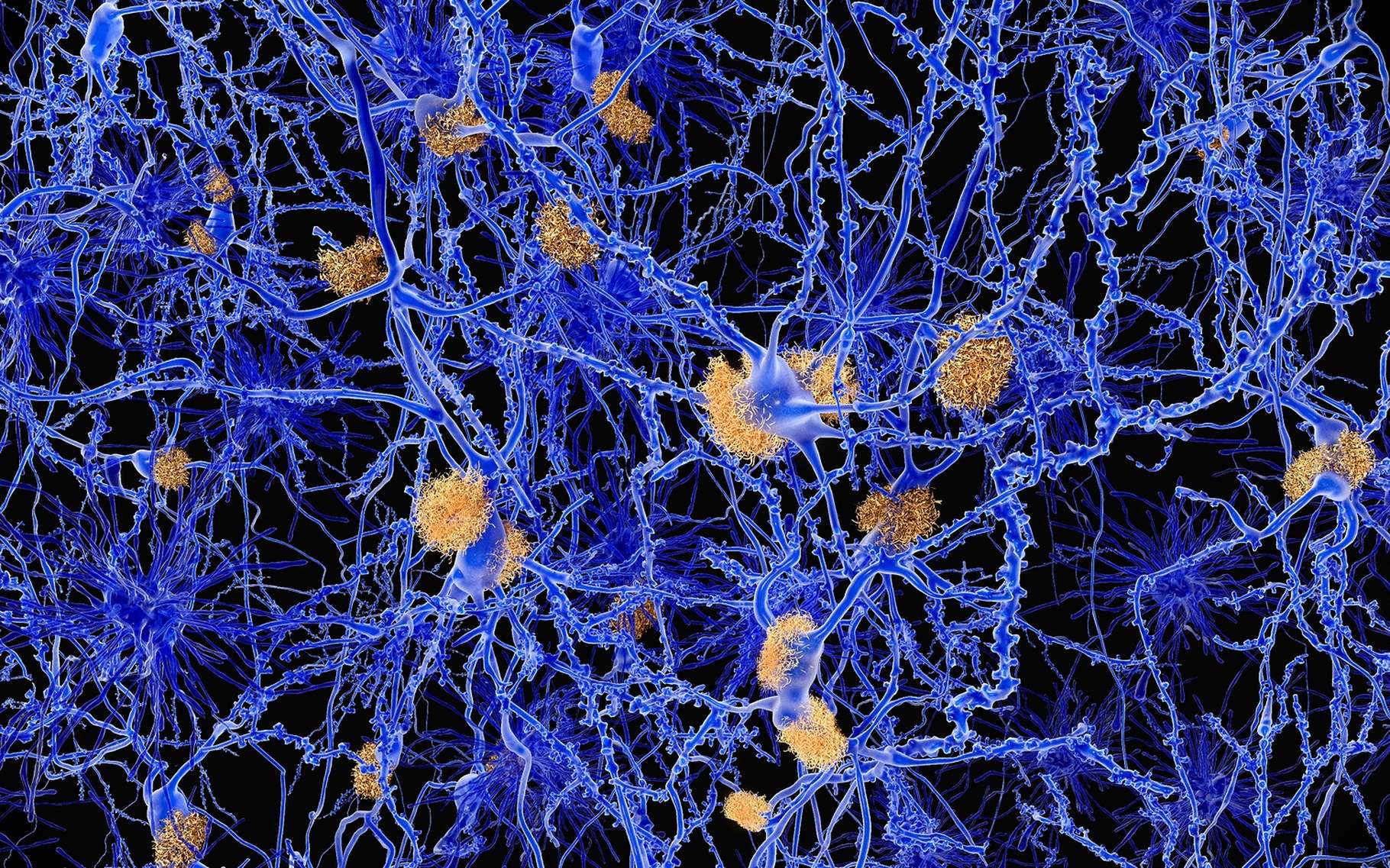 Dans la maladie d'Alzheimer, des plaques amyloïdes (ici en orange) s'accumulent entre les neurones (en bleu) et sont liées à l’agrégation de protéines mal repliées. Le phénomène est tout à fait similaire dans les maladies à prions. © Juan Gaertner, Shutterstock