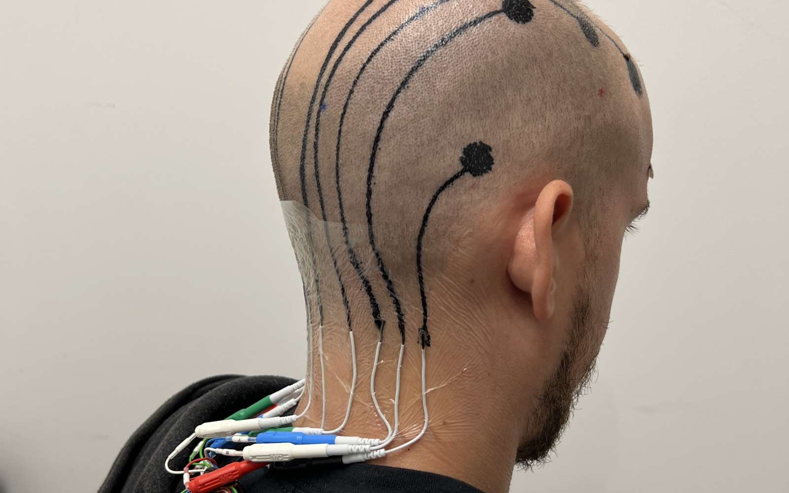 Ils ont créé des tatouages d'électrodes avec les fils sur le crâne pour détecter ce qui se passe dans le cerveau !