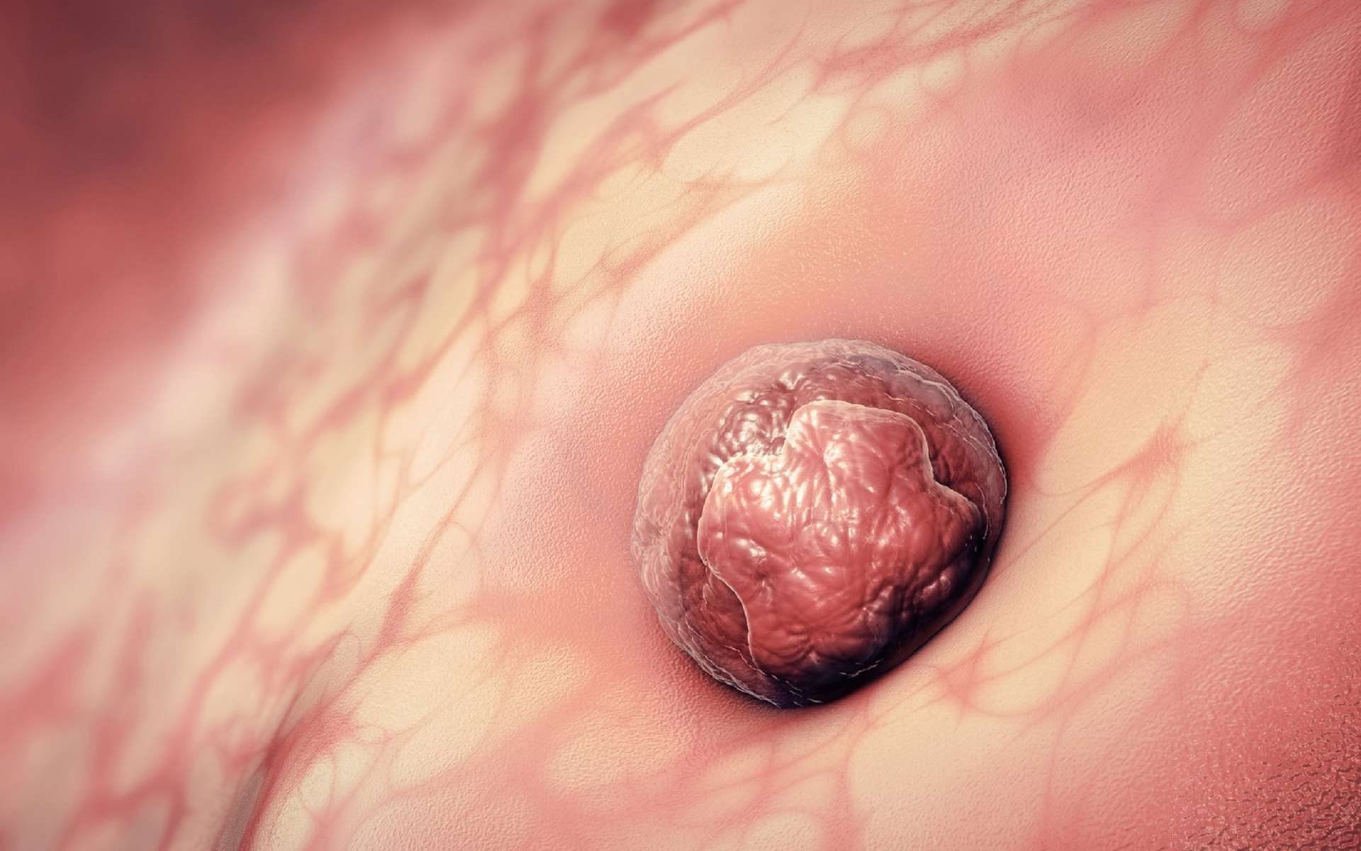 La nidation est l’étape au cours de laquelle l’embryon s’implante dans l’utérus. © Christoph Burgstedt, Fotolia