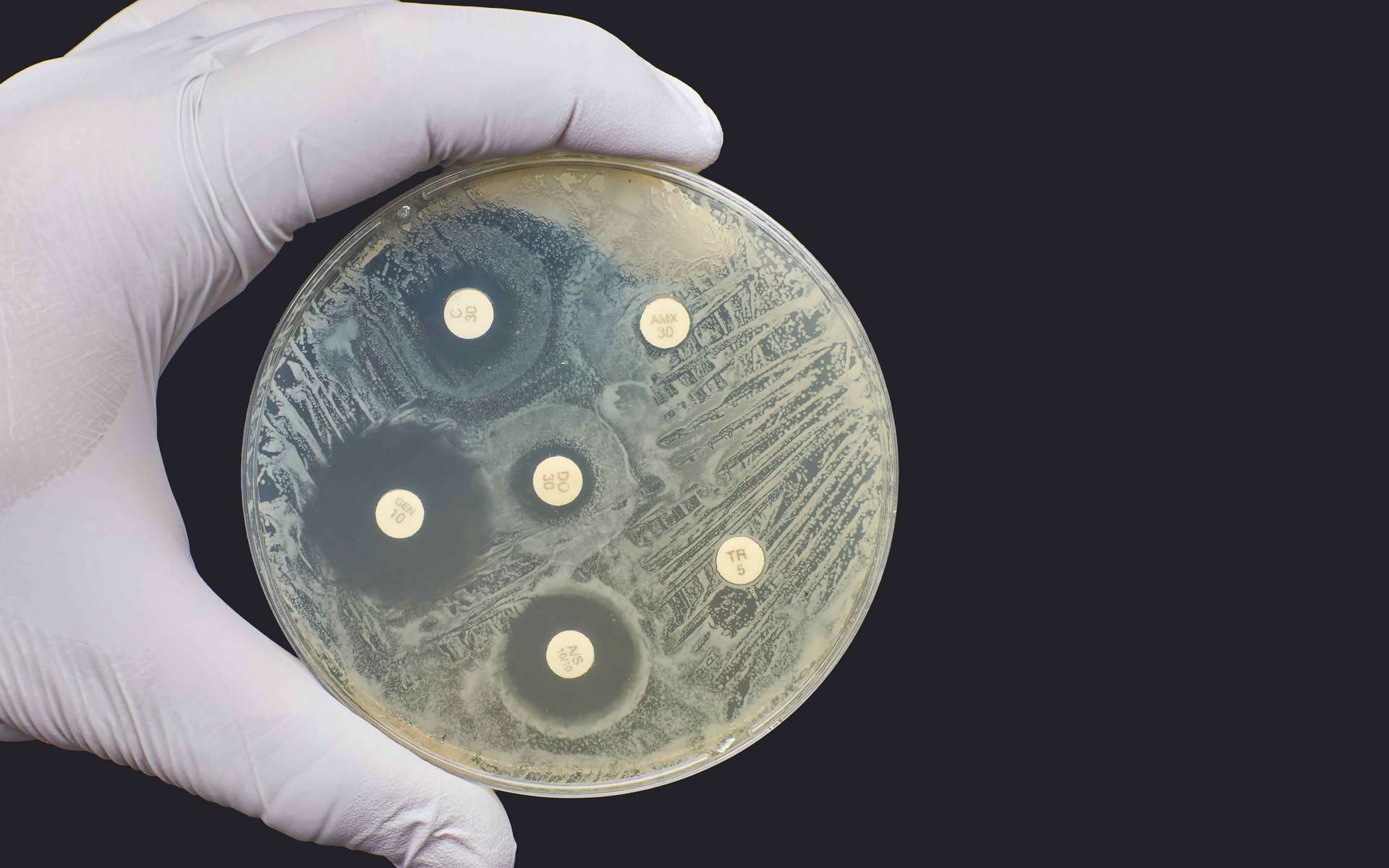 L'arrivée en France de la shigellose résistante aux antibiotiques inquiète l'Institut Pasteur