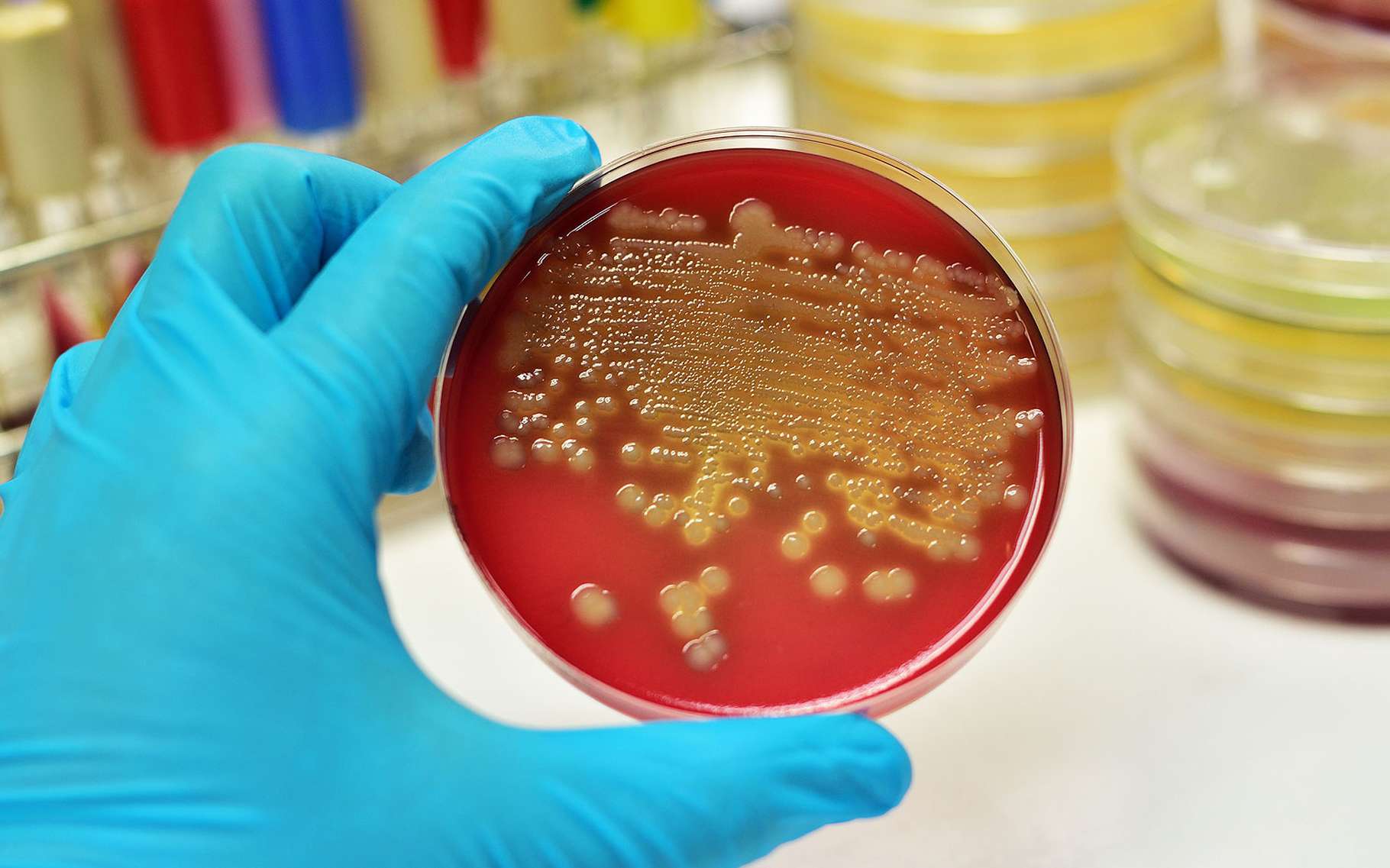 Émile Roux et le vaccin contre la diphtérie Dossier