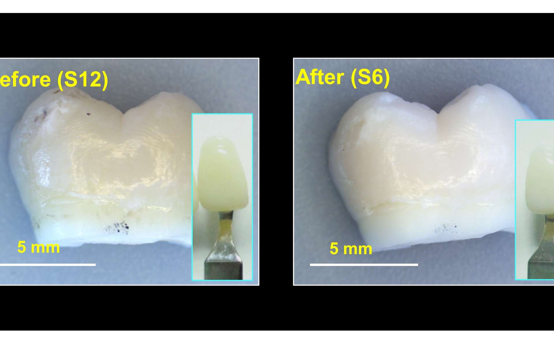 Une méthode pour blanchir les dents sans les abîmer