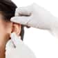 L’otoplastie est une chirurgie de correction des déformations multiples et variées des oreilles. La plus fréquente des otoplasties concerne l’opération des oreilles décollées.