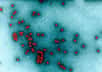 Le virus de la poliomyélite est toujours présent dans l'État de New-York, il a été détecté pour la première fois dans le comté de Nassau. Les autorités sanitaires déclarent la situation d'urgence pour protéger les habitants.