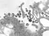 Le virus de la fièvre de Lassa au microscope électronique. © Domaine public