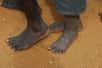 Le fait de marcher pieds nus plutôt qu’avec des chaussures favorise des callosités qui protègent le pied, sans empêcher la sensibilité tactile. C’est le résultat d’une étude réalisée au Kenya et qui a comparé les pieds de personnes marchant pieds nus ou avec des chaussures.