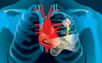 Des chercheurs ont ajouté un film de polymère aux stimulateurs cardiaques existants afin de convertir les mouvements du cœur en électricité et ainsi d'alimenter l'appareil. Le dispositif a été testé avec succès sur des animaux. 