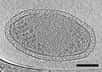 Grâce à des images microscopiques détaillées, des scientifiques apportent les preuves de l’existence de bactéries minuscules, à la limite de ce que la vie peut produire. À titre de comparaison, une bactérie E. coli pourrait contenir 150 de ces bactéries et l’extrémité d’un cheveu… 150.000 !