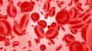 La variation de la taille de globules rouges, un indicateur couramment recherché dans les analyses sanguines standard, est fortement corrélée au risque de décéder du coronavirus, indépendamment des autres facteurs de mortalité. Un mécanisme encore inexpliqué mais qui permettrait de prendre en charge plus rapidement les patients à risque.