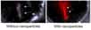 À gauche, une image de plaque d’athérome sans nanoparticules. À droite, les nanoparticules émettent des ultrasons qui sont convertis en image optique 3D. © Adv. Funct. Mater