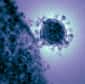 On savait la combinaison de l’interféron alpha-2b et de la ribavirine, deux molécules antivirales, efficace pour ralentir la réplication du coronavirus MERS-CoV dans des cellules en culture. Ce traitement se confirme dans le seul modèle animal connu contre le virus émergent : le macaque. Une piste qui pourrait désormais être testée chez l’Homme.