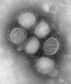 Sur cinq personnes infectées par le virus A(H1N1) pandémique, une seule présenterait des symptômes caractéristiques. Les autres ne s'en apercevraient même pas et seraient alors immunisées. C'est le résultat d'une étude française, qui pousserait donc à revoir à la baisse la dangerosité de cette grippe.