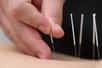 La pratique de l’acupuncture ne date pas d’hier, mais elle est souvent décriée par les scientifiques réfractaires aux médecines parallèles. Pourtant, une étude effectuée à l’université de Rochester à New York pourrait bien permettre d’expliquer d’un point de vue moléculaire les effets de cette thérapie ancestrale.