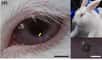 Un groupe de chercheurs coréens est parvenu à incorporer une Led sur une lentille de contact standard en se servant de nanocomposants et de graphène afin de préserver la souplesse et la transparence d’origine. À terme, ils espèrent développer un système d’affichage offrant les mêmes fonctionnalités que les lunettes connectées de Google.