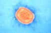 Des chercheurs américains ont conçu un virus de souris modifié de type "mousepox", cousin de celui de la variole, et capable de déjouer les pièges de la vaccination.