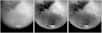 L'analyse des images acquises par la sonde européenne Huygens lors de sa descente dans l'atmosphère de Titan se poursuit. L'image du sol, prise lorsque la sonde est posée sur la surface de Titan montre un sol "plat", parsemé de blocs arrondis (galets), en forme d'ellipsoïdes assez plats et disposés à plat, du moins au premier plan (blocs numéroté 1, 2, 3 et 8). Autour du bloc 4, on devine un "sillon en creux" entourant ce bloc.