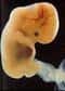 Aux Etats-Unis, la raison essentielle avancée par le gouvernement actuel pour expliquer son opposition au financement par des fonds fédéraux des recherches sur les cellules embryonnaires humaines est la crainte de destruction d'embryons pour la production de cellules souches.