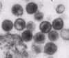 L'enzyme cellulaire Apobec3G, découverte en 2002, peut être considérée comme un mécanisme d'immunité innée contre le virus du Sida.