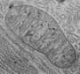 L'aconitase, enzyme mitochondriale impliqué dans le cycle de Krebs, c'est-à-dire dans la production d'énergie, vient de révéler une facette jusqu'ici inconnue de son activité. Le Dr Ronald Butow et son équipe de l'Université Sud du Texas, ont mis en évidence le rôle clef de cet enzyme dans la protection du génome mitochondrial.