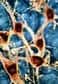 A partir de cellules souches prélevées sur des embryons humains, une équipe américaine est parvenue à créer des neurones spécialisés secrétant de la dopamine, ce médiateur chimique qui fait défaut dans la maladie de Parkinson.