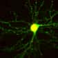 Grâce à des anticorps fluorescents qui s’attachent sur des protéines neuronales, des chercheurs ont pu visualiser l’activité des neurones dans le cerveau de souris vivantes. Leurs résultats mettent en évidence le mouvement continu des liaisons cérébrales.