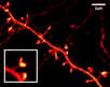Moins de 70 nanomètres ! C’est la résolution record des détails de véritables films montrant les modifications des dendrites de neurones de souris bien vivants, obtenus grâce à une nouvelle technique, la microscopie Sted. Les neurobiologistes disposent maintenant d’un nouvel outil pour comprendre les pathologies des synapses.