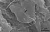 Des chercheurs japonais de l’Université de Shinshu ont étudié l’influence de l’injection de nanotubes de carbone sur la régénération des tissus osseux. Selon eux, le temps de réparation des fractures pourrait être réduit grâce à la présence de ces nanotubes... au moins chez la souris