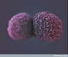 Le cancer se caractérise par la multiplication incontrôlée de cellules, qui aboutit à la formation d'une masse appelée tumeur. C'est l'objet d'étude de l'oncologie. © Anne Weston, Wellcome Images, cc by nc nd 2.0