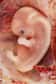 Durant la grossesse, le fœtus peut être exposé à des agents environnementaux qui vont modifier non pas l'enchaînement des bases azotées de l'ADN, mais l'expression des gènes (l'épigénétique). Caractère transmis à toutes les cellules filles, l'épigénome ainsi modifié peut alors entraîner un cancer dans les premières années de la vie.