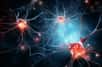 Illustration de plaques amyloïdes sur une cellule nerveuse de la maladie d'Alzheimer. © Queralt, Adobe Stock