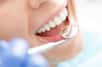 Alternative à l'amalgame dentaire pour soigner une carie : stimuler les capacités naturelles de la dent à se réparer elle-même, en activant les cellules souches de la pulpe. C'est ce que pourrait faire le Tideglusib, un médicament anti-Alzheimer capable de régénérer la dent chez des souris.
