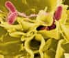 Souvent à la une des journaux, les salmonelles sont responsables d’infections intestinales assez sévères. Ces bactéries ne sont pas pour autant complétement néfastes et limitent l’inflammation des voies respiratoires chez la souris. Des chercheurs allemands ont analysé cette propriété et voudraient s’en inspirer pour mettre au point un cocktail probiotique contre l’asthme.