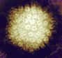Selon une vaste étude britannique, le zona, une maladie causée par la réactivation du virus de la varicelle, augmenterait fortement les risques d’accidents vasculaires. Les scientifiques recommandent donc d’améliorer la surveillance médicale à la suite de cette pathologie.