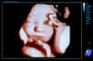 Comment réagit le fœtus au régime alimentaire de sa maman ? Ce qu'ont souhaité approfondir des chercheurs en observant les réactions faciales du futur bébé in utero. L'exposition prénatale aux différentes saveurs ingurgitées par la mère a été analysée et prouve pour la première fois que le petit être en devenir a déjà ses préférences.