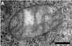 Il faut avoir de bons yeux, mais l'on peut apercevoir sur la droite de la mitochondrie des petits points noirs, qui révèlent en fait la présence de l'ADN de l'organiste cellulaire. La barre noire représente 200 nm. © Iborra et al. 2004, BioMed Central