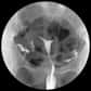 L'hystérographie est un examen radiographique de l’utérus et des trompes. © Diagnosezentrum Hietzing

