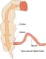 L'iléon constitue la dernière partie de l'intestin grêle, et abouche dans le colon au niveau du caecum. © Wikimedia Commons