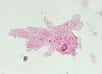 Amibe : Amoeba proteus