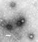 Le poliovirus (vu au microscope électronique) possède une réplicase qui a été largement étudiée en biologie moléculaire. © DR