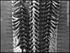 Les dents chitineuses recouvrant cette radula de calmar géant, genre Architeuthis, sont particulièrement bien mises en évidence sur cette photographie prise au microscope électronique à balayage. © Smithsonian