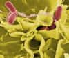La salmonelle est une bactérie pathogène responsable de la salmonellose et de la fièvre typhoïde. © DR