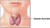 La thyroïde (à l'image), située en bas du cou, régule le métabolisme basal du corps. Lorsqu'elle est trop active, comme dans l'hyperthyroïdie, le moteur de l'organisme tourne plus vite, et il s'ensuit notamment une perte de poids malgré un appétit identique. © NIH, Wikipédia, DP